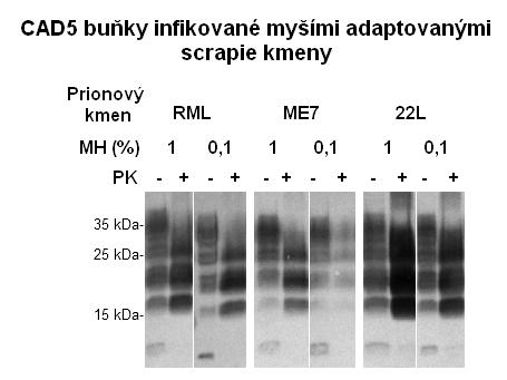5.1 Senzitivita CAD5 buněk k infekci různými prionovými kmeny 45 20krát nižší, viz 4.2.2).