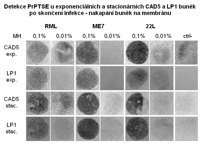 5.3 Přenos prionové infekce závisle i nezávisle na buněčném kontaktu 57 Obr. 15: Detekce přítomnosti PrP TSE u exponenciálních a stacionárních CAD5 a LP1 buněk po skončení infekce (tj.