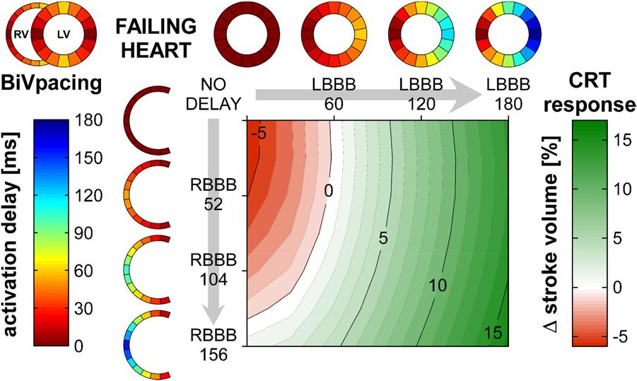 538 Circ Arrhythm Electrophysiol June 2014 Downloaded from http://circep.ahajournals.