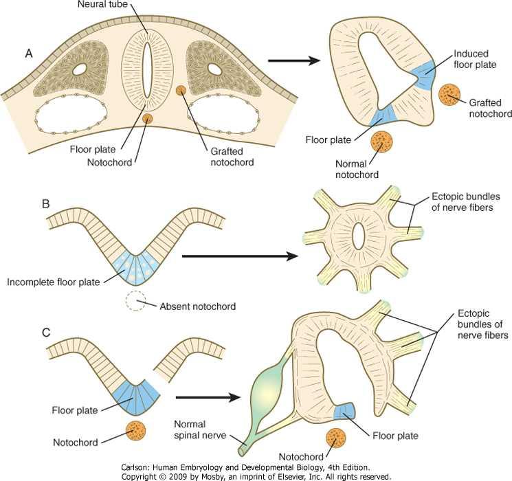 Downloaded from: StudentConsult (on 11 January 2013 02:02 PM) Figure 11-7 Experiments illustrating the influence of the notochord on development of the floor plate and exit sites of nerves from the