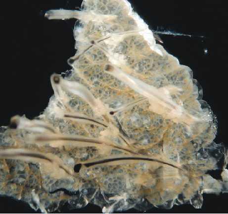 Isolation of human epidermal neural crest stem