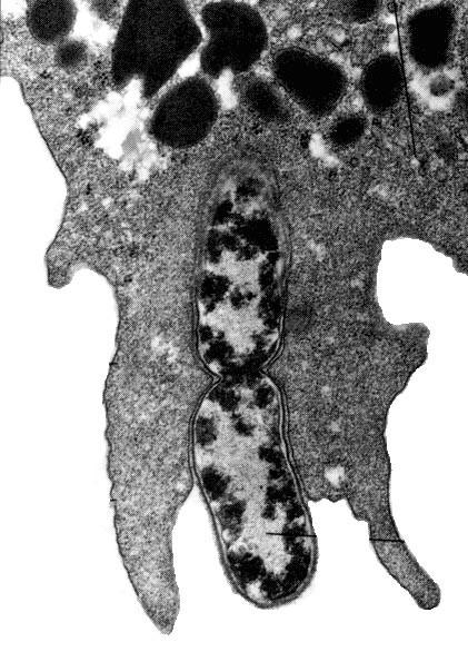 LYZOSOMY A PEROXISOMY sférické membránové organely obsahující nebezpečné látky LYZOSOMY trávicí aparát buňky odbourávají bílkoviny, nukleové kyseliny,