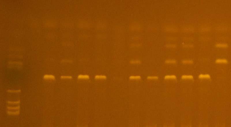 Tabulka 5.: Přehled restrikčních enzymů [22] Gen Restrikční enzym (New England Biolabs) Restrikční místo Po restrikci CYP 453 HpyF10VI...GCNNNNNNNGC......CGNNNNNNNCG......GCNNNNN NNGC......CGNN NNNNNCG.