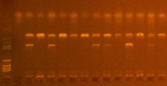 7-variantní homozygot GSTM1 1 2 3 4 5 1 marker