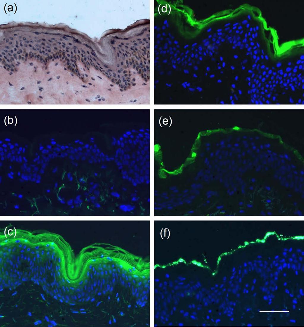 hydrofobní, aby se rozdělovaly ze stratum corneum do hydrofilní živé epidermis. 19 Pomocí permeačních pokusů bylo zjištěno, že ceramidy s krátkým acylovým řetězcem zvyšují kožní propustnost. 12 Obr.