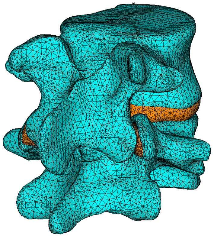 Spodní terminální ploše obratle L5 bylo předepsáno zamezení všech posuvů a natočení. Řešení bylo provedeno ve výpočtovém systému Ansys.