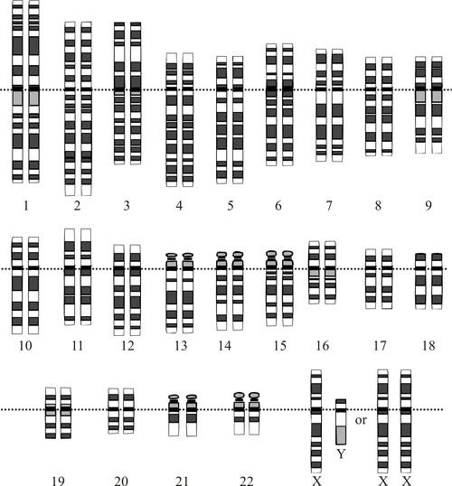 Chromozomová výbava Ideogram, idiogram = grafické schema zobrazující chromozomové proužky vzniklé například metodou G-banding (Gproužkování