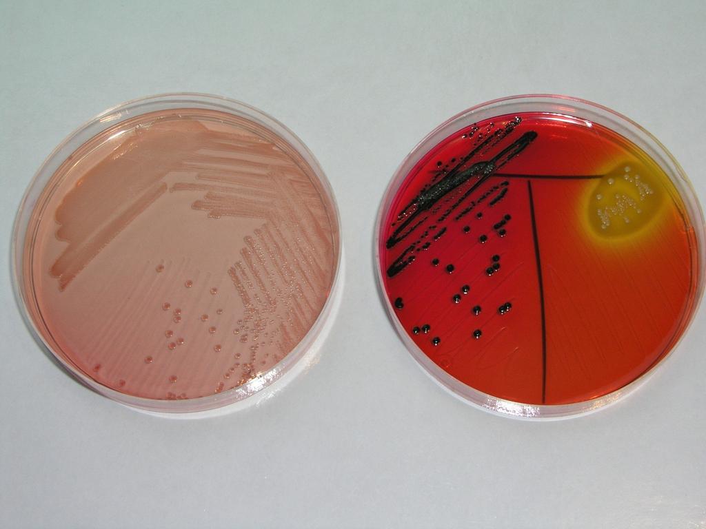 Salmonella sp.