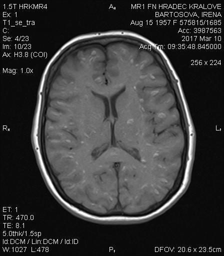 MRI mozku 10.3.