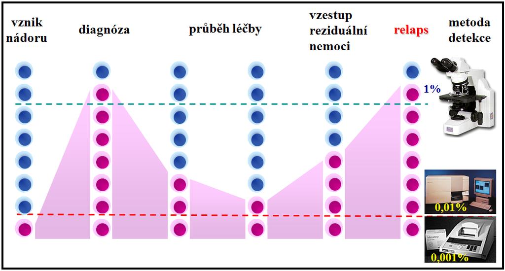 výsledků lze u pacientů s ALL předpovědět možný relaps onemocnění a včas zahájit léčebnou reakci (Brüggemann et al., 2012). Obr. č.