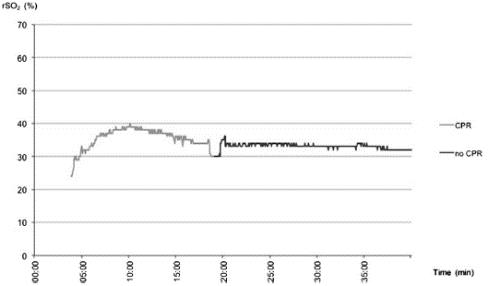 NEAR INFRARED SPECTROSCOPY (NIRS)