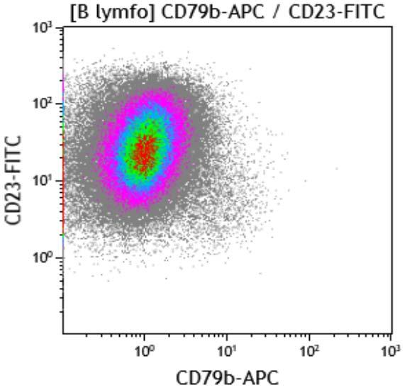 WBC CD23+, CD200+, ROR1+,