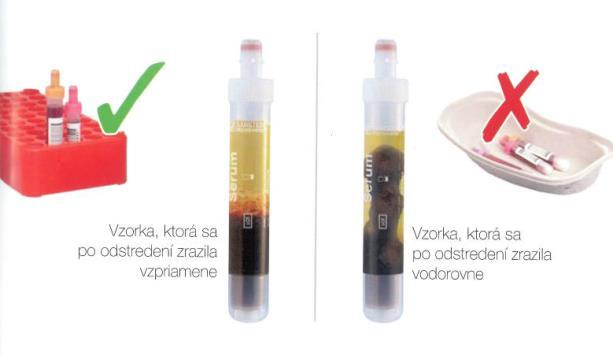 Uchovávanie vzoriek po odbere krvi Po