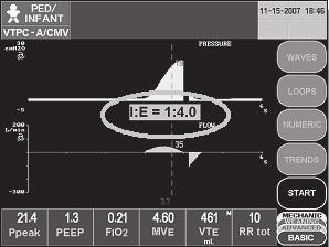 Dodatok k modelu T Vyskakovacie okno Real Time I:E ratio A Keď sa používateľ pokúša nastaviť Resp Rate, t insp, Flow, Pause alebo Tidal Volume, uprostred dotykovej obrazovky sa v reálnom čase zobrazí