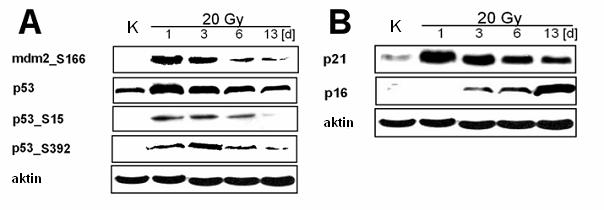 6.1.7 Ionizující záření indukuje senescenci u KBZP Protein p21 není u KBZP za normálních okolností exprimován.