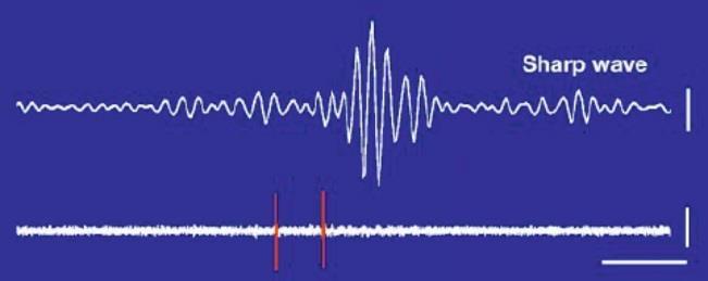 interneuronů