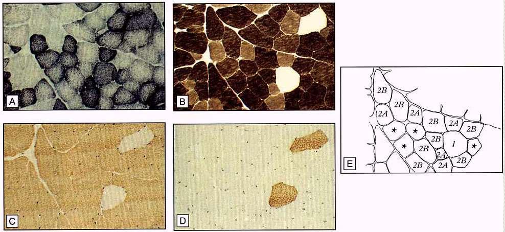 Gray s Anatomy Znázornění typů svalových vláken histochemický průkaz katalytickou reakcí na myozinovou