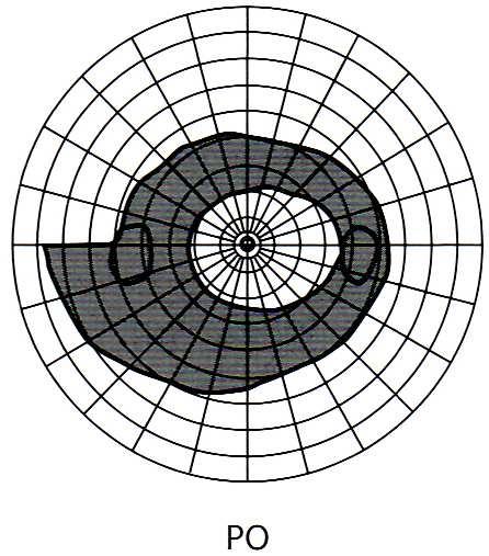 perimetrie.