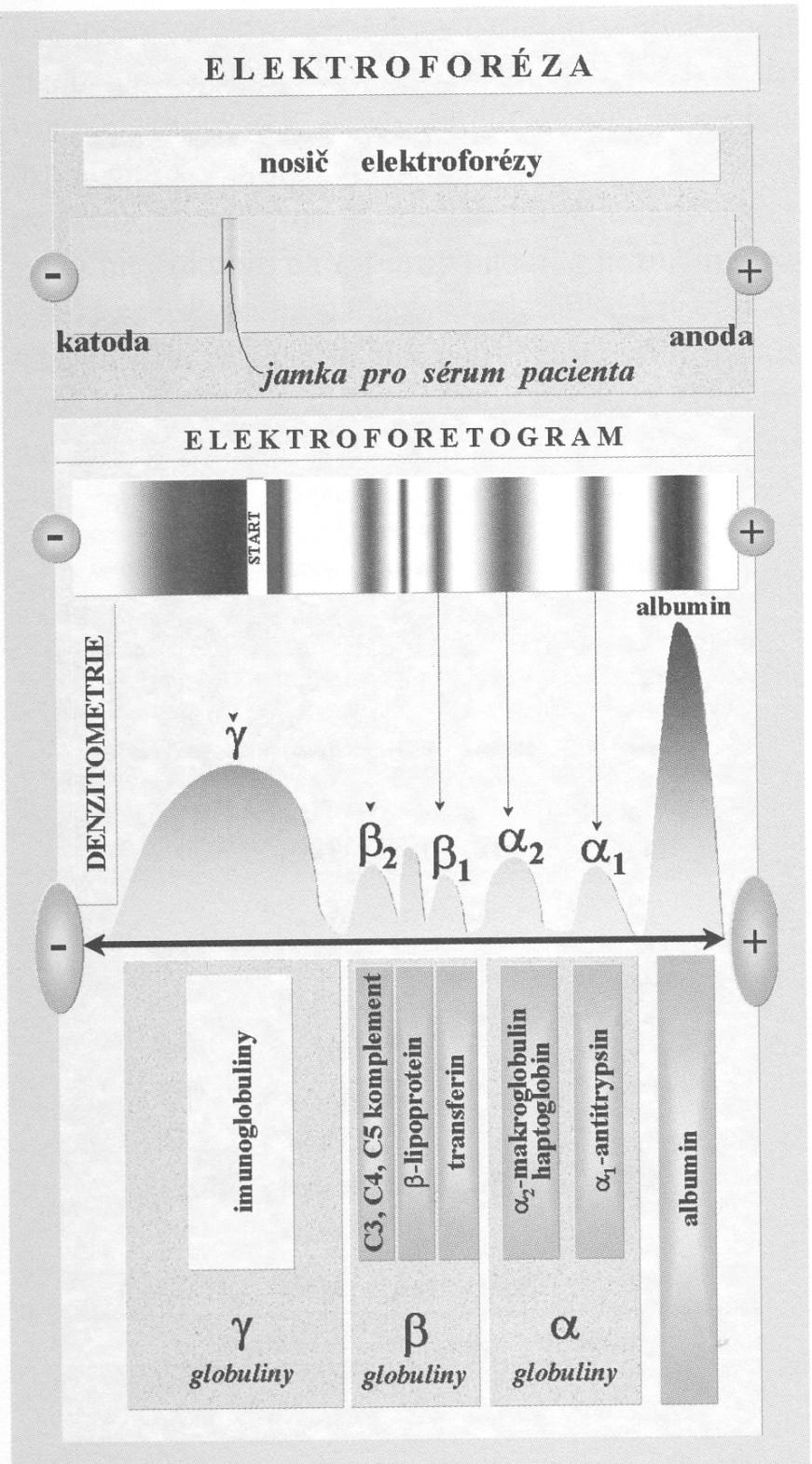 Elfo sérových proteinů Při běžné elfo se sérum dělí na zónu albuminu, α 1, α 2, β, γ globulinů.