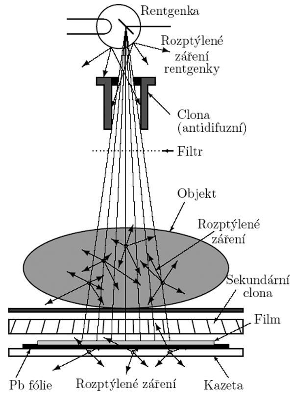 Zpracování a detekce RTG záření Vysoká energie fotonů RTG záření znemožňuje usměrňování RTG paprsku.