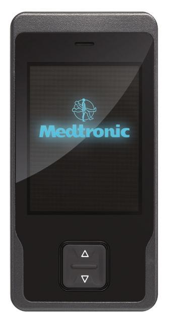 Do blízkosti nervů, které ovládají močový měchýř a které se nacházejí v dolní části zad, je zavedena elektroda (tenký drátek).