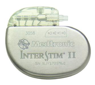 Fáze implantace terapie InterStim Pokud bude fáze hodnocení úspěšná, může vám lékař nabídnout trvalou implantaci systému InterStim. Co je systém InterStim?