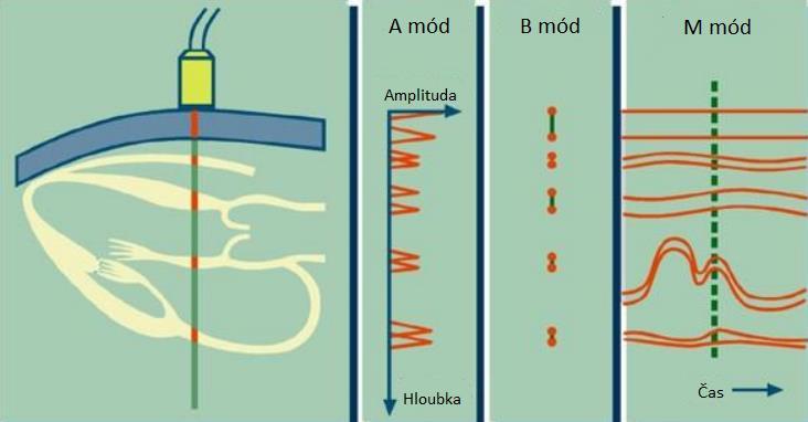 2.2.1 A mód zobrazení A zobrazení vychází z amplitudové modulace signálu.