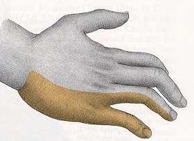 palce, je nemožná fl. 2. a 3. prstu N.