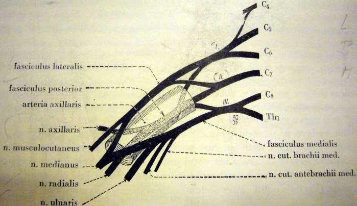 Schéma plexus brachialis Ventrální větve C5 Th1 (C4) Truncus
