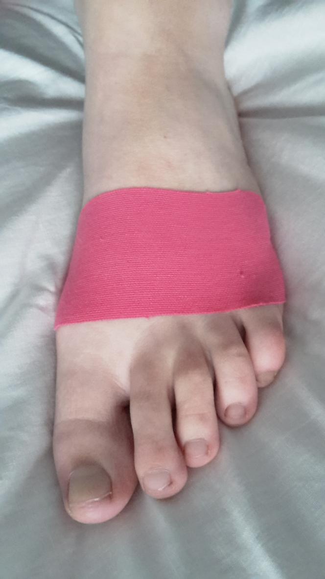 Příloha 5 Kineziotaping