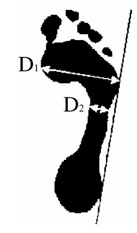 a nejširším místem podogramu. Šířkové rozměry (v mm) se měří na kolmici k zevní tečně otisku chodidla.