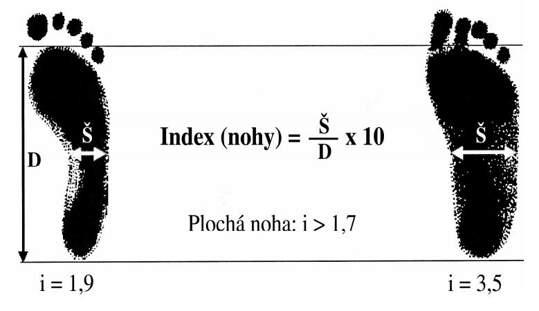 a šířky nohy měřené při bazi 5. metatarzu. Přesný výpočet vypadá takto: šířka / délka * 10.