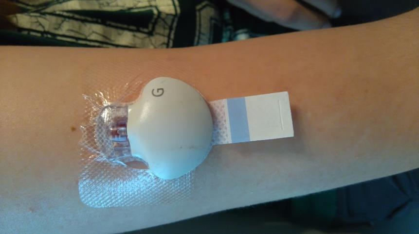 Po ukončení CGM pacient nebo zdravotník převede údaje z příslušného