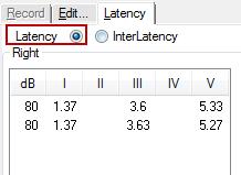 Latency (Latence). 3.