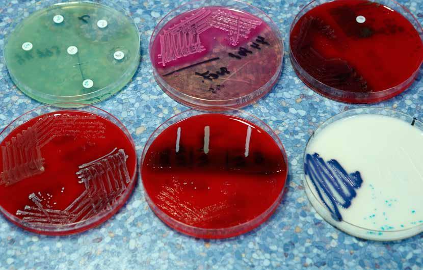 Služby Nové laboratoře klinické mikrobiologie vyhotoví denně 500 testů Oddělení klinické mikrobiologie Nemocnice PRIVAMED se loni na podzim přestěhovalo do nových prostor, což umožnilo jeho