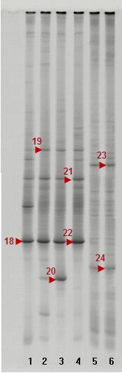 Tab. 1 Mnoţství a druh mikroorganismů v bioplynu Druh/vzorek Bioplyn za fermentorem [mil. bakterií.m -3 ] Bioplyn za adsorpční jednotkou [mil. bakterií.m -3 ] Celkem buněk 7,630 3,100 C.