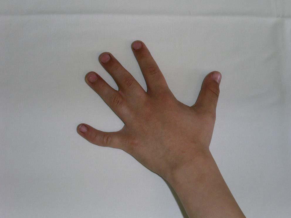Vrozené vývojové vady