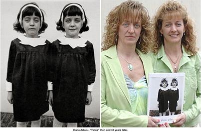 100 Diane Arbus, Dítě s hračkou Obr.