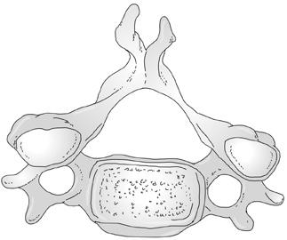Anatomické poznámky 17 Obr. 1.3. Krční obratel. 1 processus spinosus, 2 arcus vertebrae, 3 processus articularis sup.
