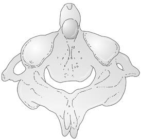 , 7 sulcus arteriae vertebralis, 8 arcus post. 7 2 3 6 5 11 1 10 2 9 3 Obr. 1.5. Axis. 1 facies articularis post.