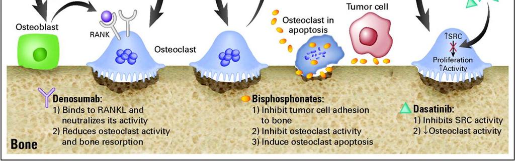 Mechanismus účinku bone specific preparátů na kostní metastázu Pierrick G.