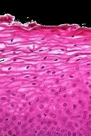 2. Dlaždicobuněčný epitel a výskyt HPV infekce Povrch děložního čípku je tvořen dlaždicobuněčným nerohovatějícím epitelem (obr.3).
