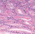 Use Agilent s FTIR imaging microscopy systems to distinguish between cancerous and