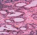 study the mechanisms of how cells move through tissues.