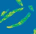 Using optical microscopes sections of prostate tissue can be graded according to the