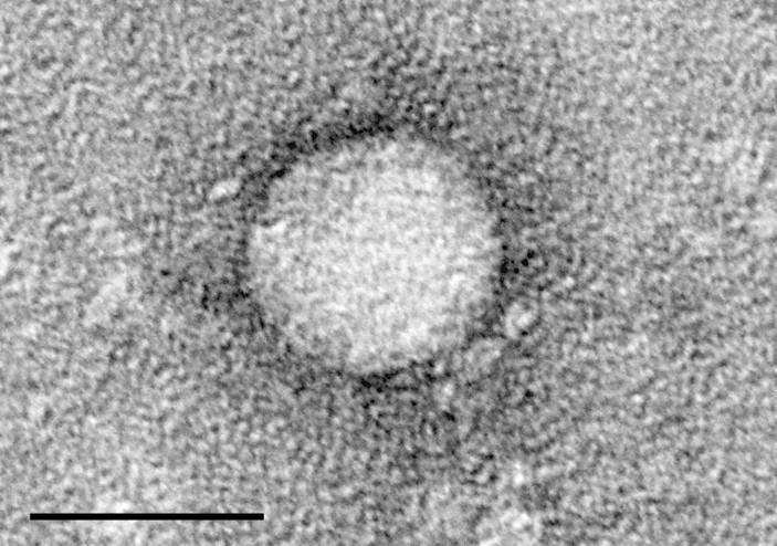 Virus hepatitidy C Čeleď Flaviviridae,