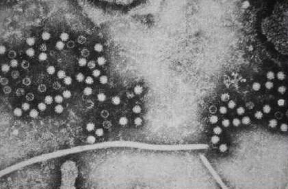 Virus hepatitidy E Nezařazený (podobný