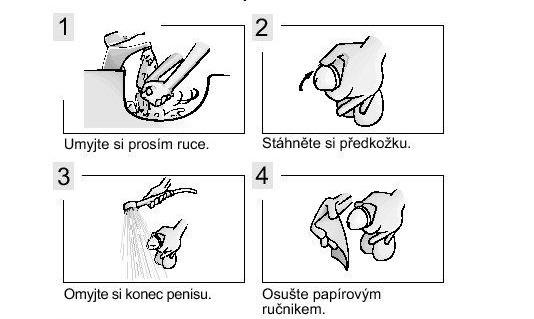 Odběr moče u muže postup