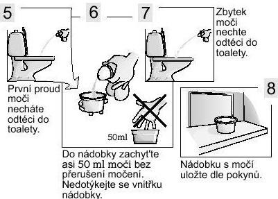 Odběr moče u muže postup