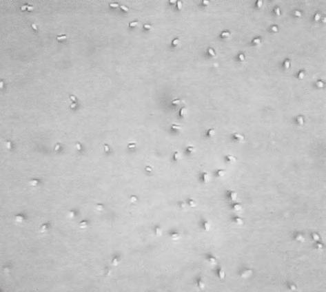 Foto 1. Intenzita napadení Nosema spp. hodnocená jedním plus (+). Foto 2. Intenzita napadení Nosema spp. hodnocená dvěmi plusy (++). Foto 3. Intenzita napadení Nosema spp. hodnocená třemi plusy (+++).
